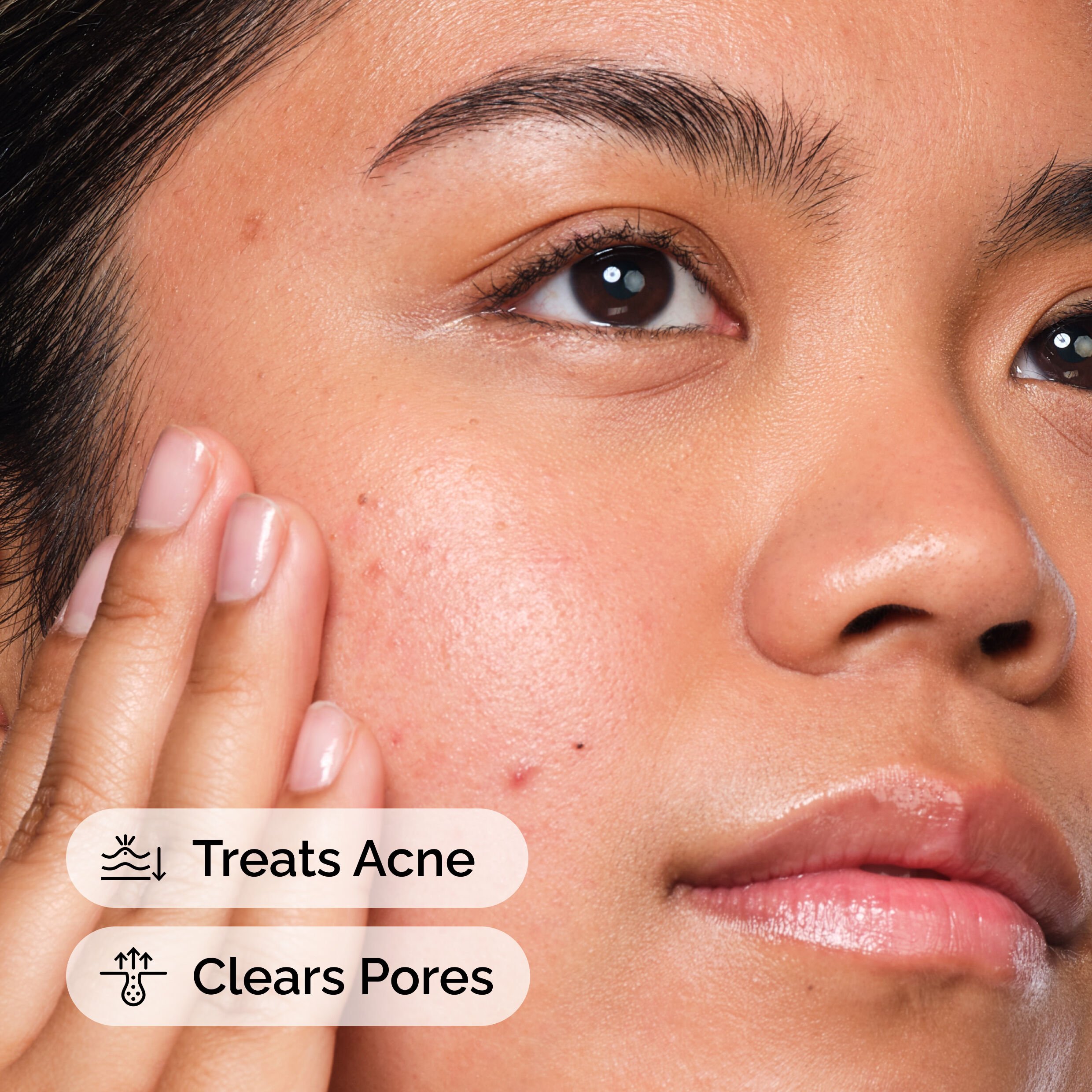 Salicylic Acid 2% Solution 30ml - Image 2