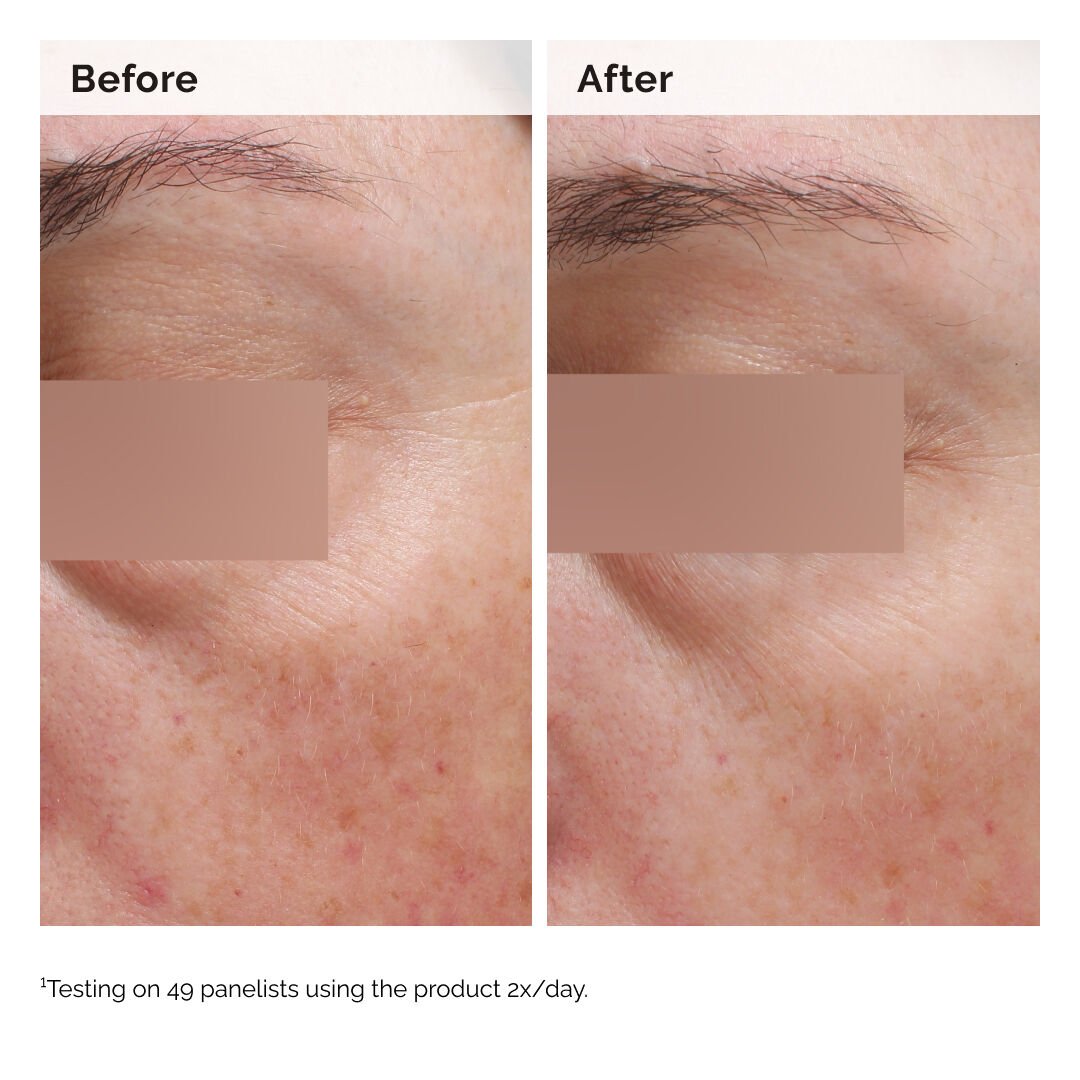 Niacinamide 5% Face and Body Emulsion 100ml - Image 3