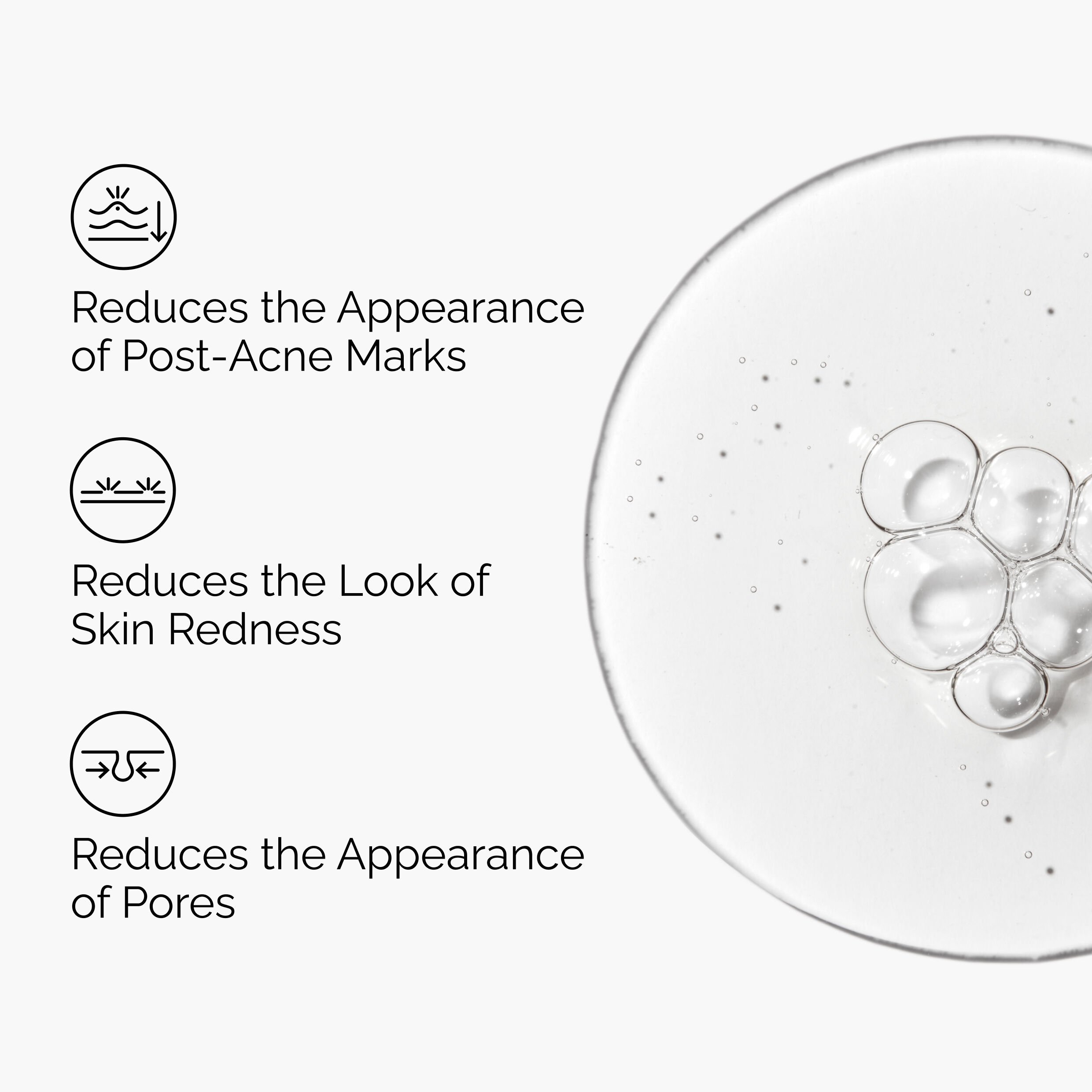 Post-Acne Marks Reduction with Aloe 2% + NAG 2% Solution 30ml - Image 4