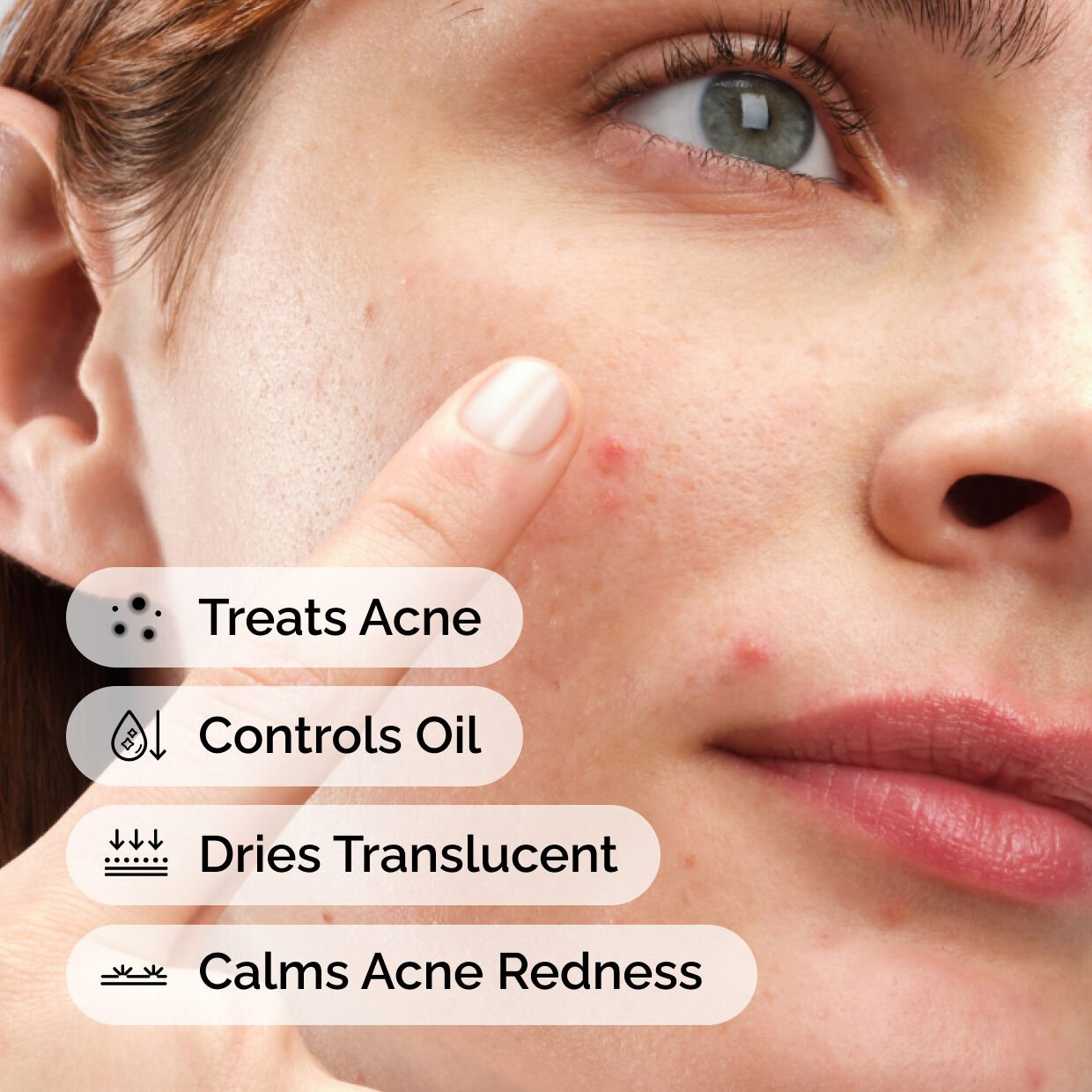 Sulfur 10% Powder to Cream Concentrate US5g - Image 2